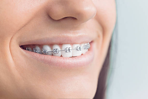 Best Veneers and Lumineers  in Camp Hill, AL